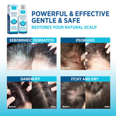Roycederm acondicionador para cabello sano con hidratación suave.