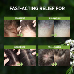 RoyceDerm espray cabello sensación refrescante: hidratación ligera para uso diario