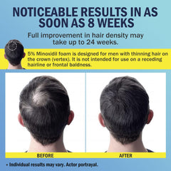 Cabello más grueso y denso con uso regular de Ruahouine Minoxidil.