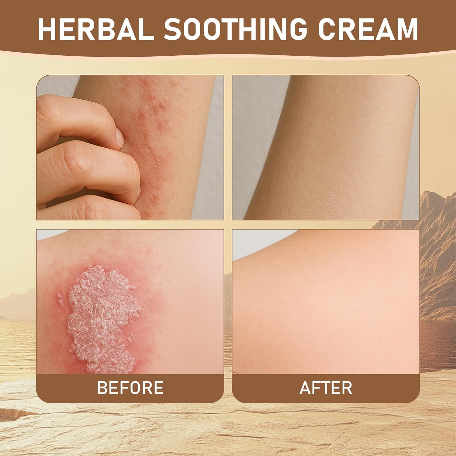 Rulinal crema hierbas: nutrición profunda para piel áspera.