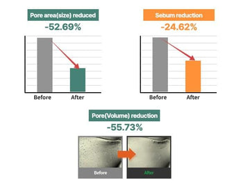 Piel sensible soporta S.NATURE AQUA SQUALANE crema sin irritación