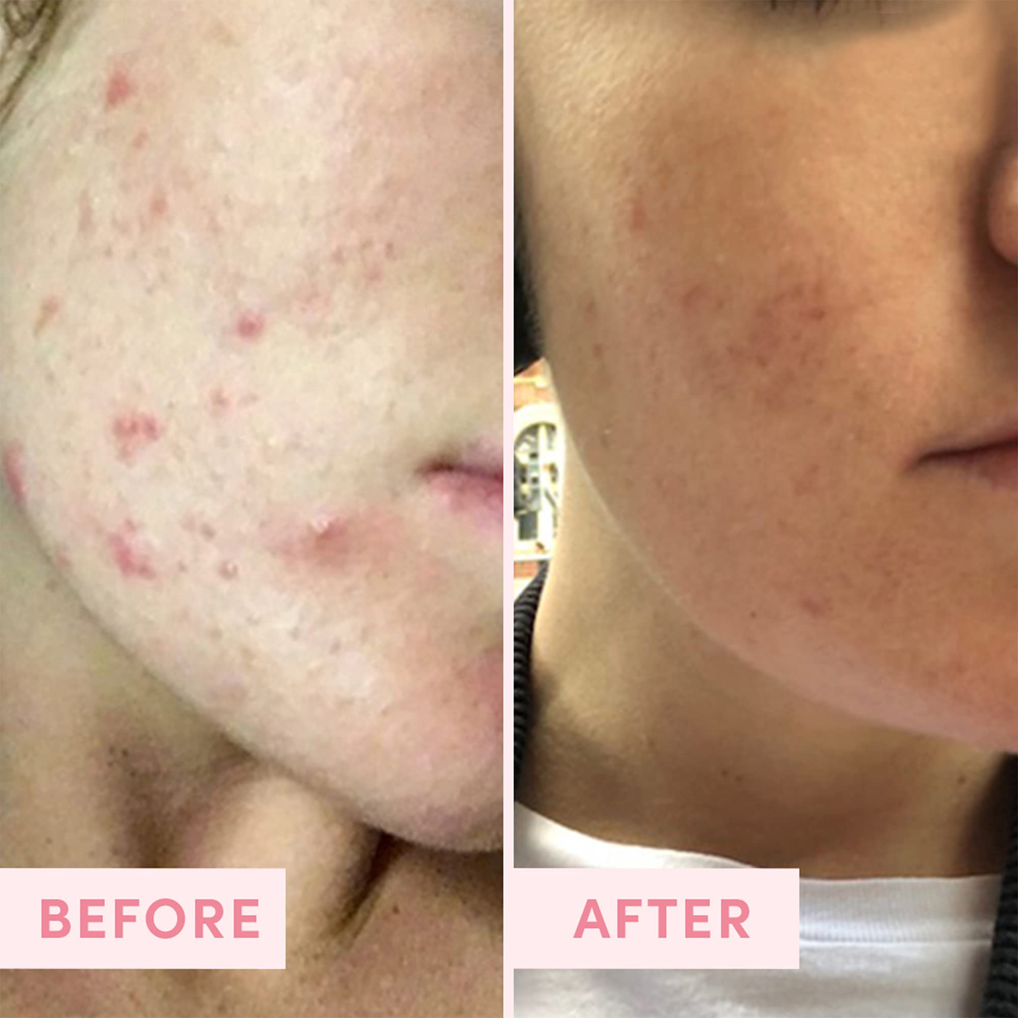 Sand & Sky arcilla rosa muestra color suave y propiedades detoxificantes