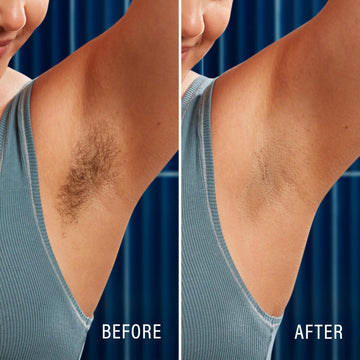 Schick Hydro Silk: apta para piernas, brazos, axilas y zona bikini.