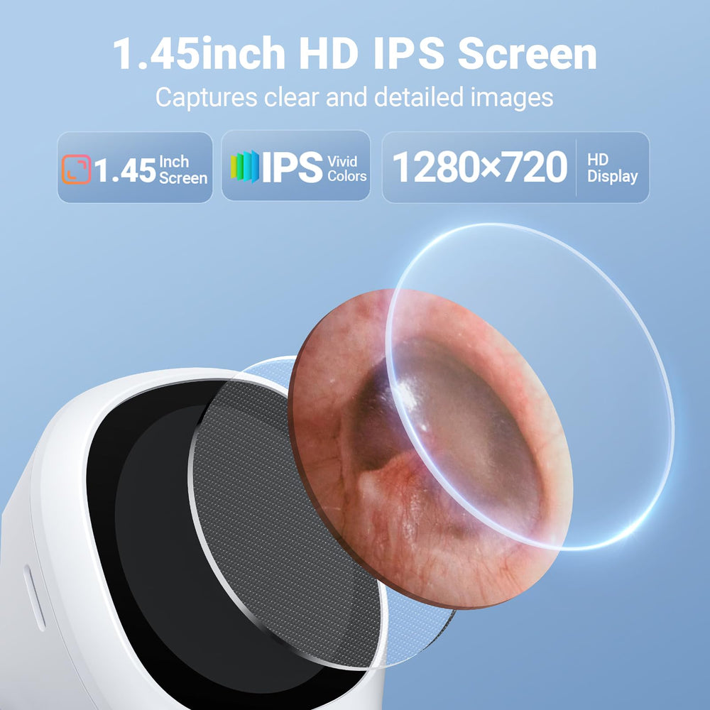 ScopeAround Otoscopio con cámara de oído de 3.9 mm para detalle preciso.