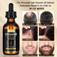 Sefralls Minoxidil para barba, aplicación precisa para densidad y apariencia más completa.