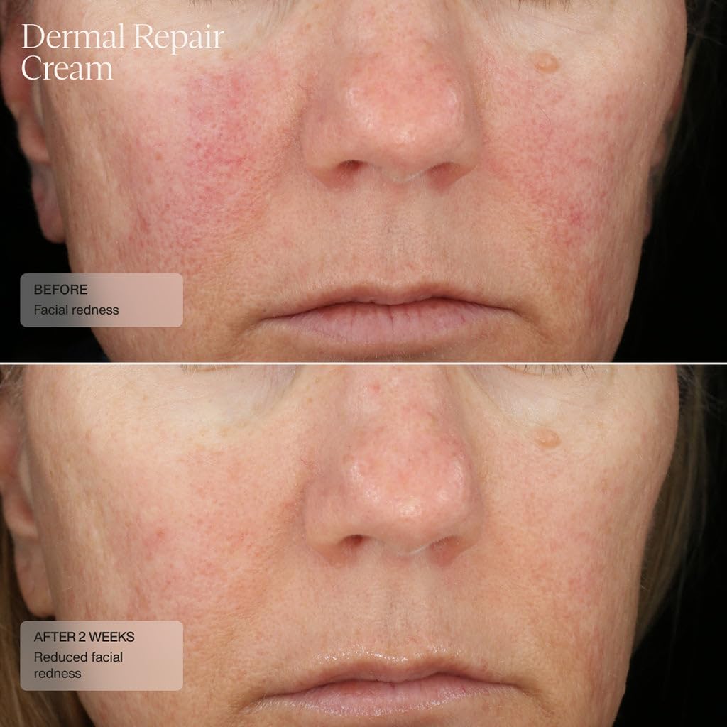 Aplicación de Senté Dermal Repair con dedos para rostro y cuello