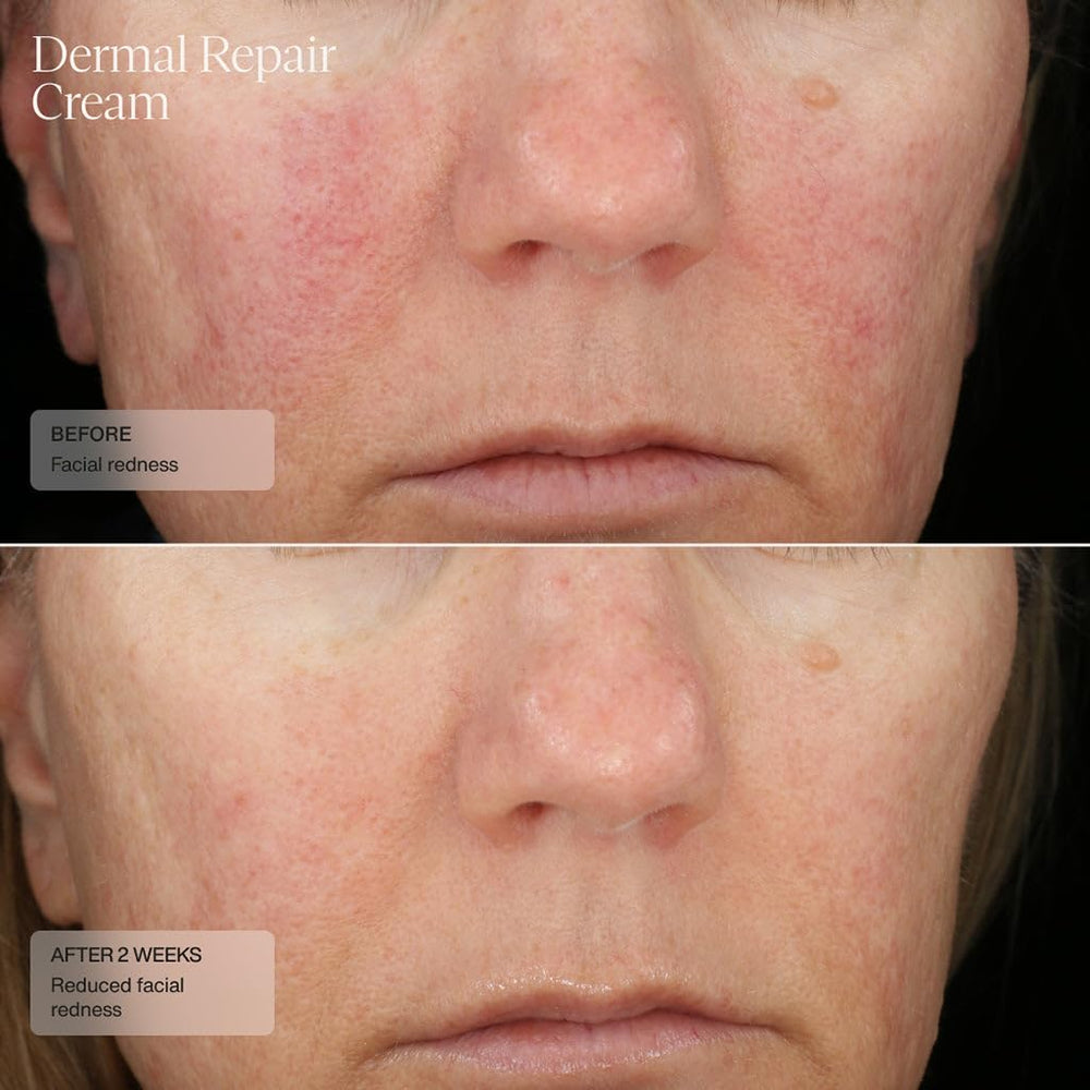 Aplicación de Senté Dermal Repair con dedos para rostro y cuello