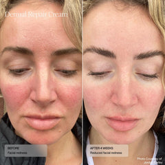 Textura cremosa de Senté Dermal Repair para piel suave y nutrida