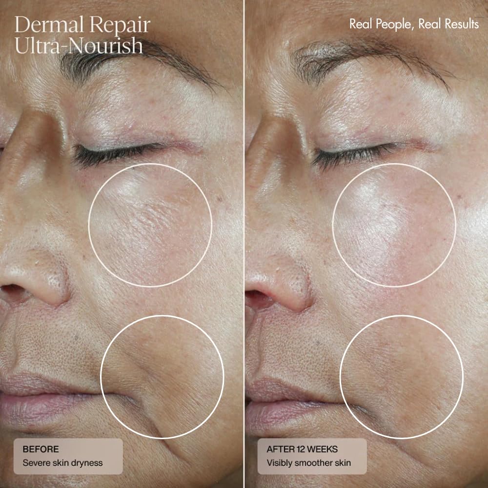 Aplicación de una pulsación en rostro y cuello tras la limpieza con Senté.