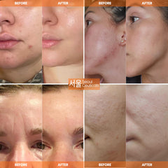 SeoulCeuticals usage matin et soir – routine simple et efficace.
