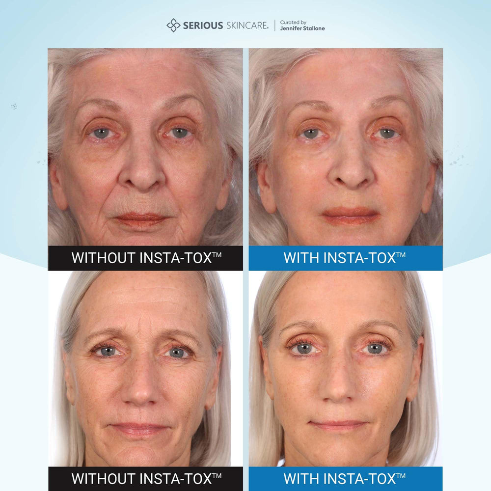 INSTA-TOX de Serious Skincare, atenúa arrugas profundas y líneas finas.