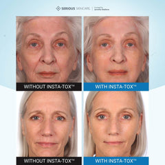 INSTA-TOX de Serious Skincare, atenúa arrugas profundas y líneas finas.