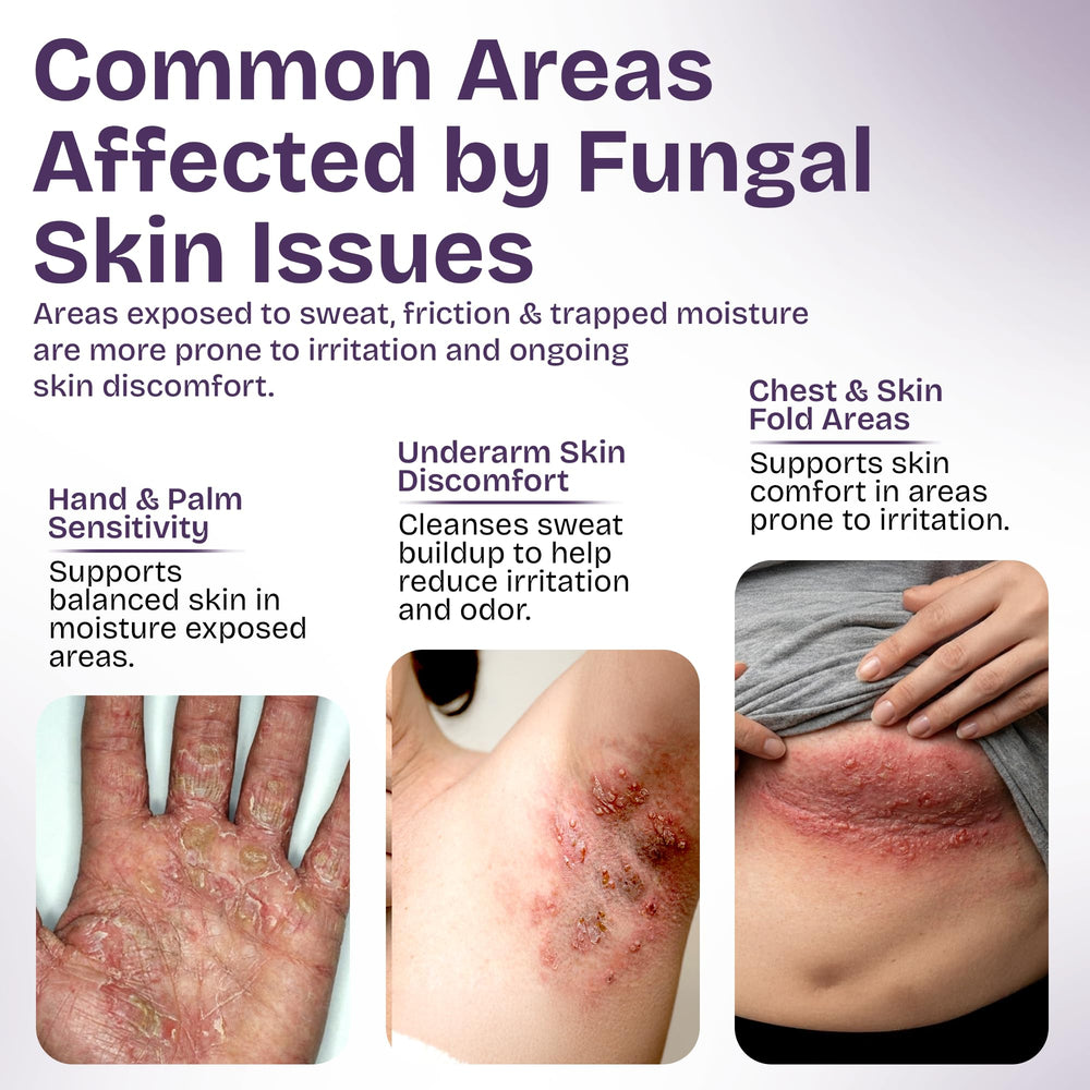 Ingredientes aromáticos de Shailee Árbol de Té para piel fresca