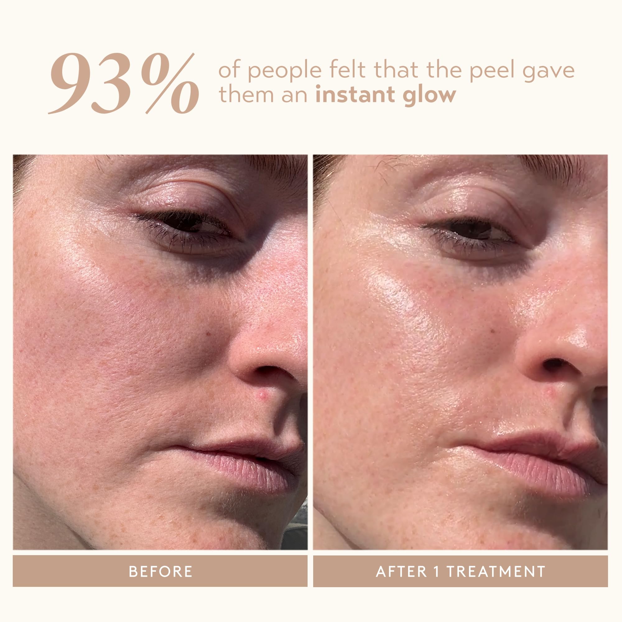 SHANI DARDEN Triple Acid Peel: textura-piel-suave tras la exfoliación en casa