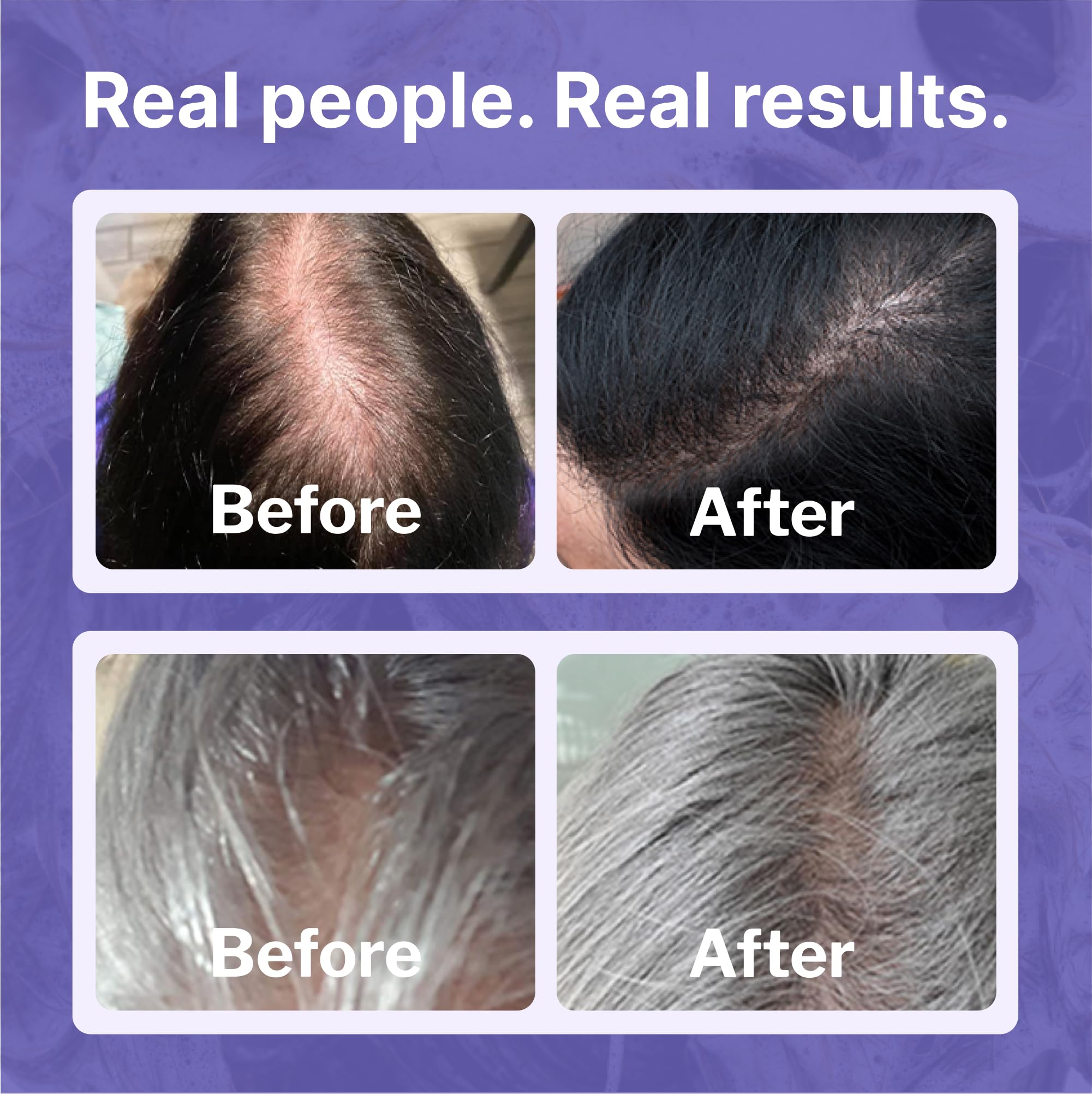 Shapiro MD Regrowth Espuma Leave-In: aplicación rápida para protección diaria.