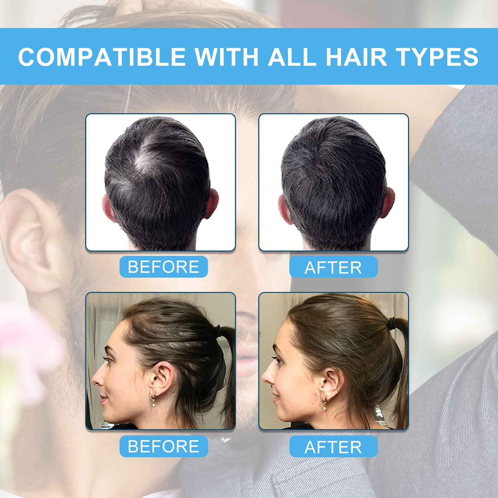 SHIFAKOU Fibras capilares crean densidad instantánea en cabello.