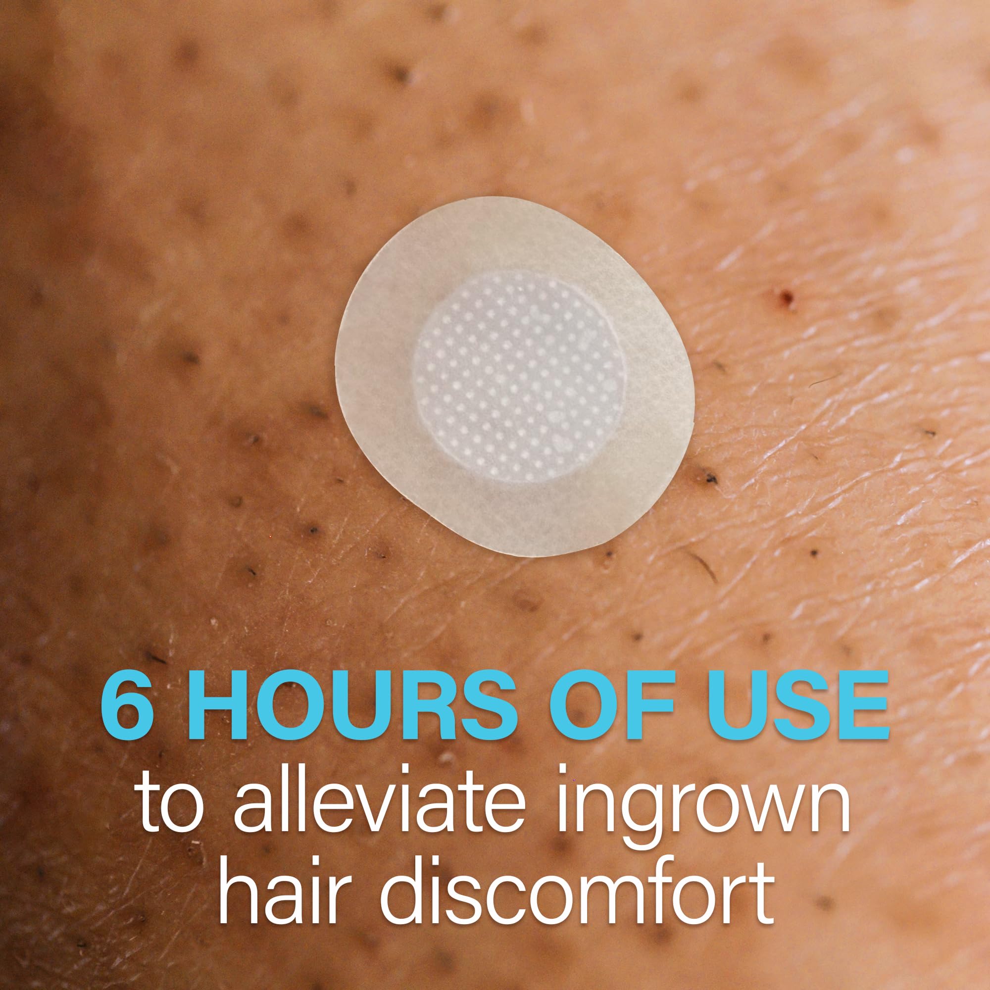 Aplicación segura en zonas sensibles con ShineMore y alivio gradual.