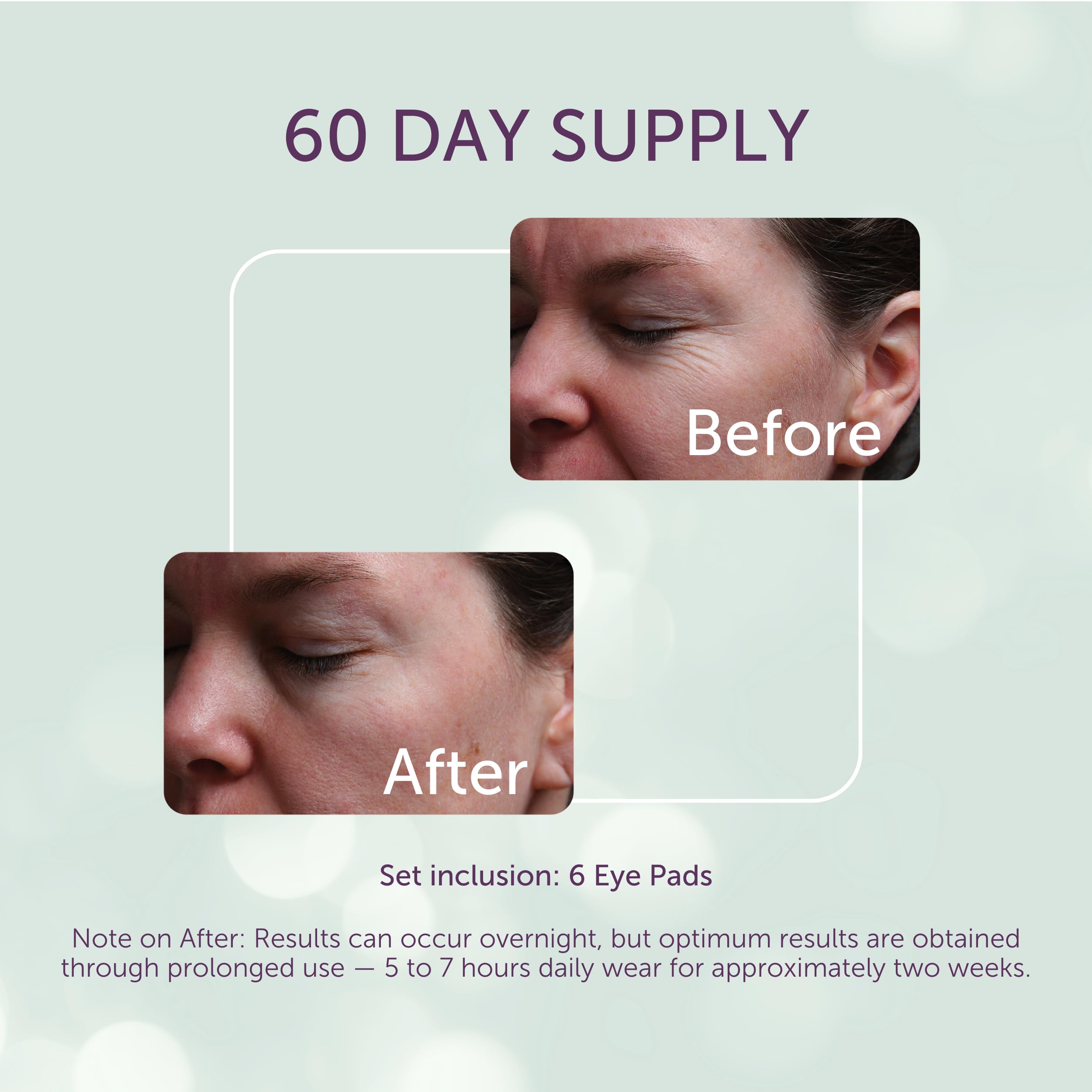 Patchs yeux Silc Skin – hypoallergenique évite les irritations autour des yeux.