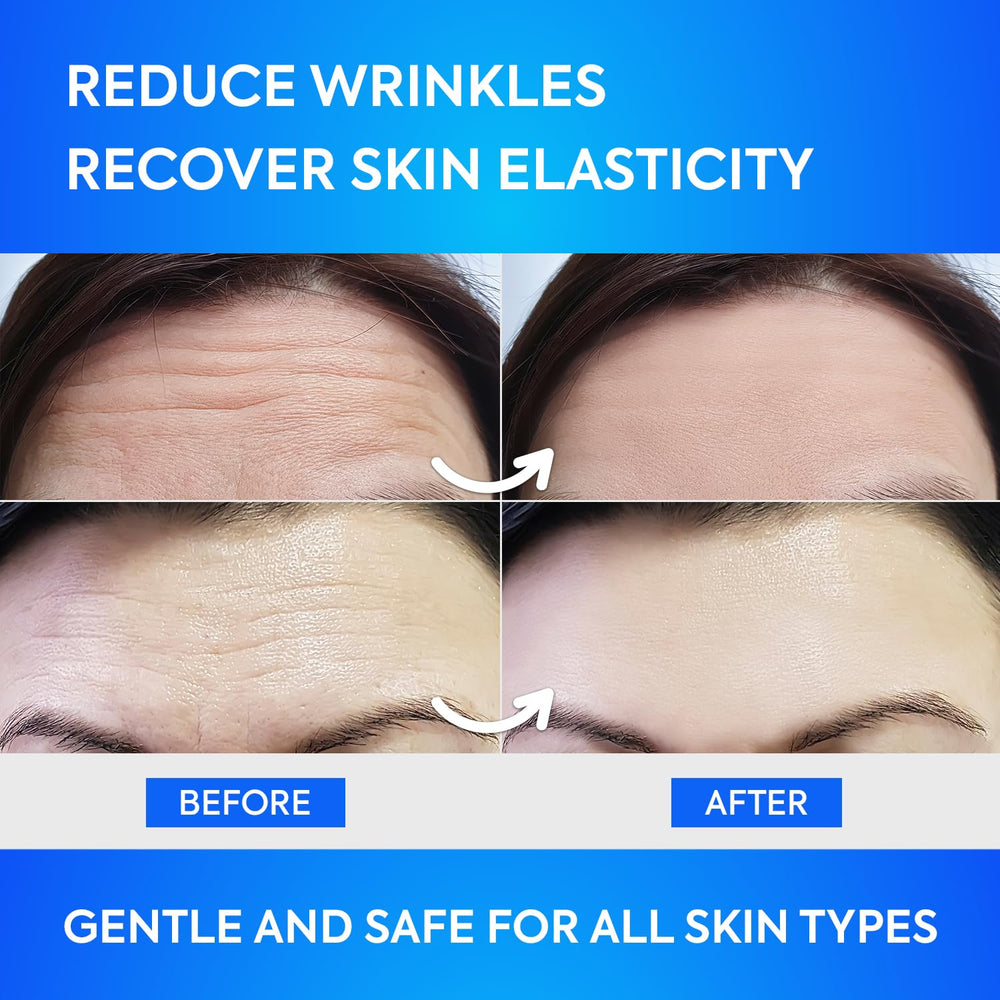 Parche Silkdermis frente, hidratación y nutrientes para una sensación de piel fresca.