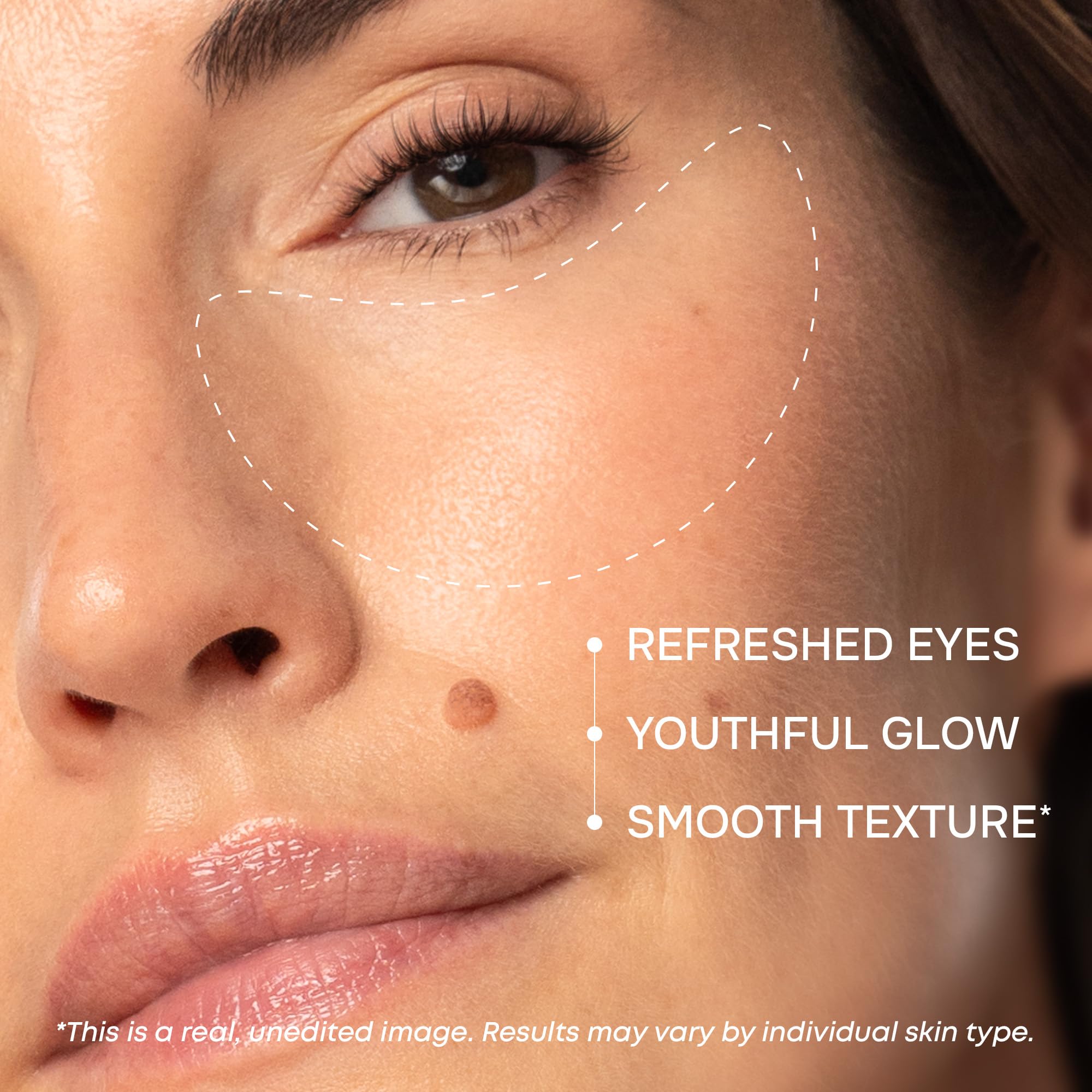 Parches SimplyVital con colágeno suavizan la piel alrededor de los ojos para un aspecto suave