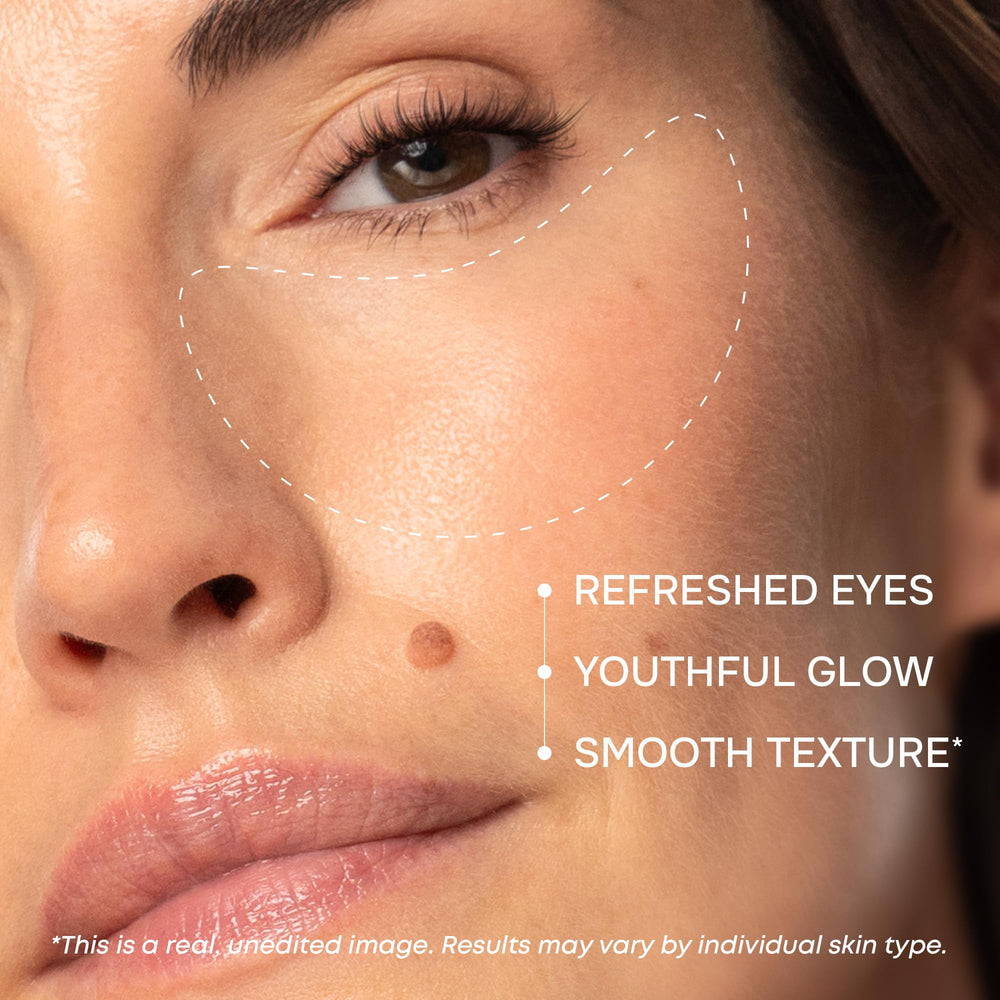 Parches SimplyVital con colágeno suavizan la piel alrededor de los ojos para un aspecto suave