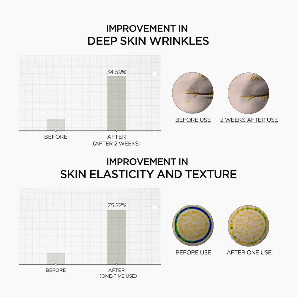 SKIN1004 hidratación profunda para piel sensible