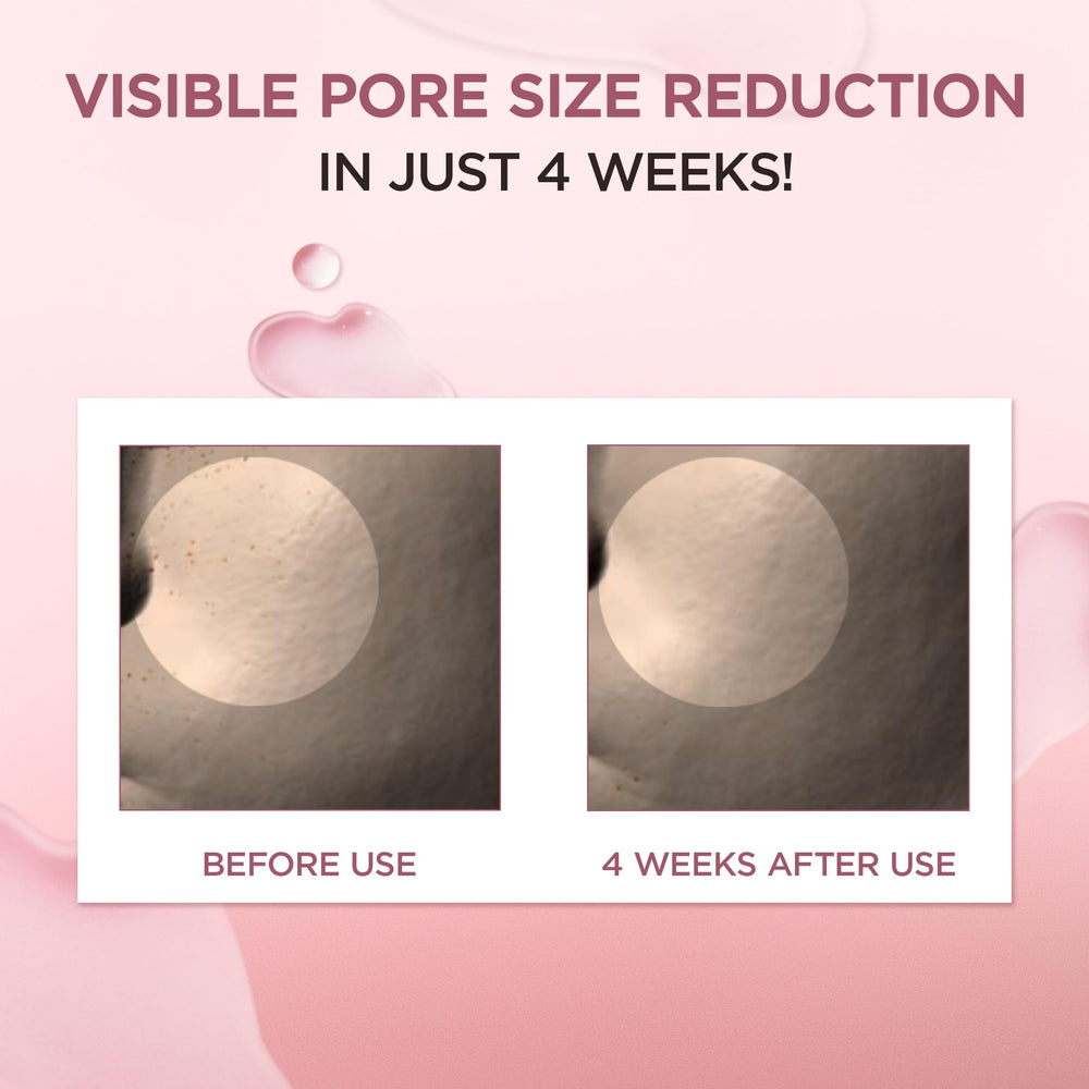 SKIN1004 Madagascar Centella Poremizing Fresh Ampoule regulacion-sebo para un aspecto más claro