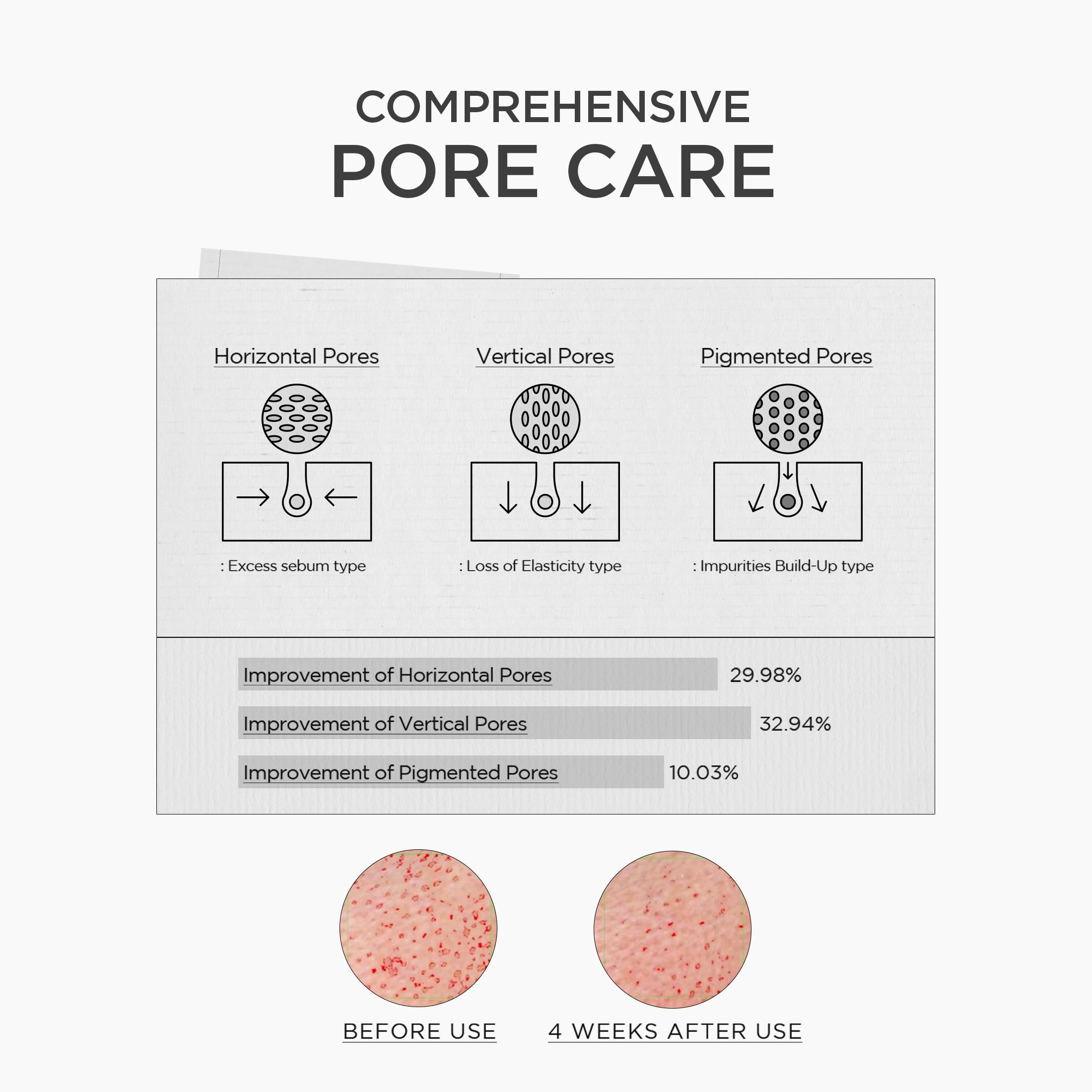 SKIN1004 Niacinamide 10% Boosting Shot ampoule-pipette for precise dosing.