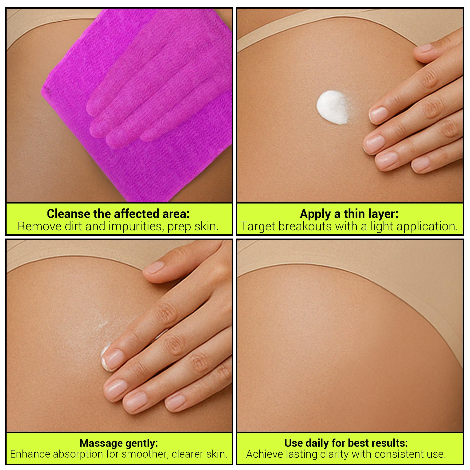 SKINBOSS tratamiento acne espalda-pecho: cuidado de zonas difíciles
