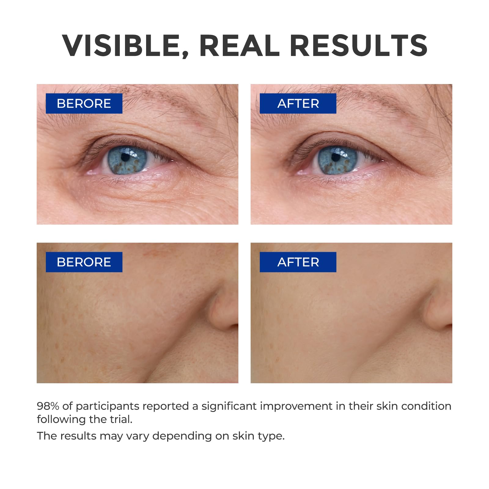 Aplicación de absorcion rápida del serum SKINERSE durante la noche.