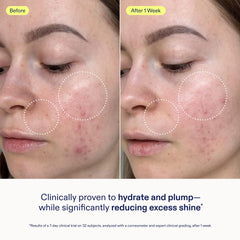 Aplicación en la palma de Skinfix Gel Crema Barrera para hidratación diaria.