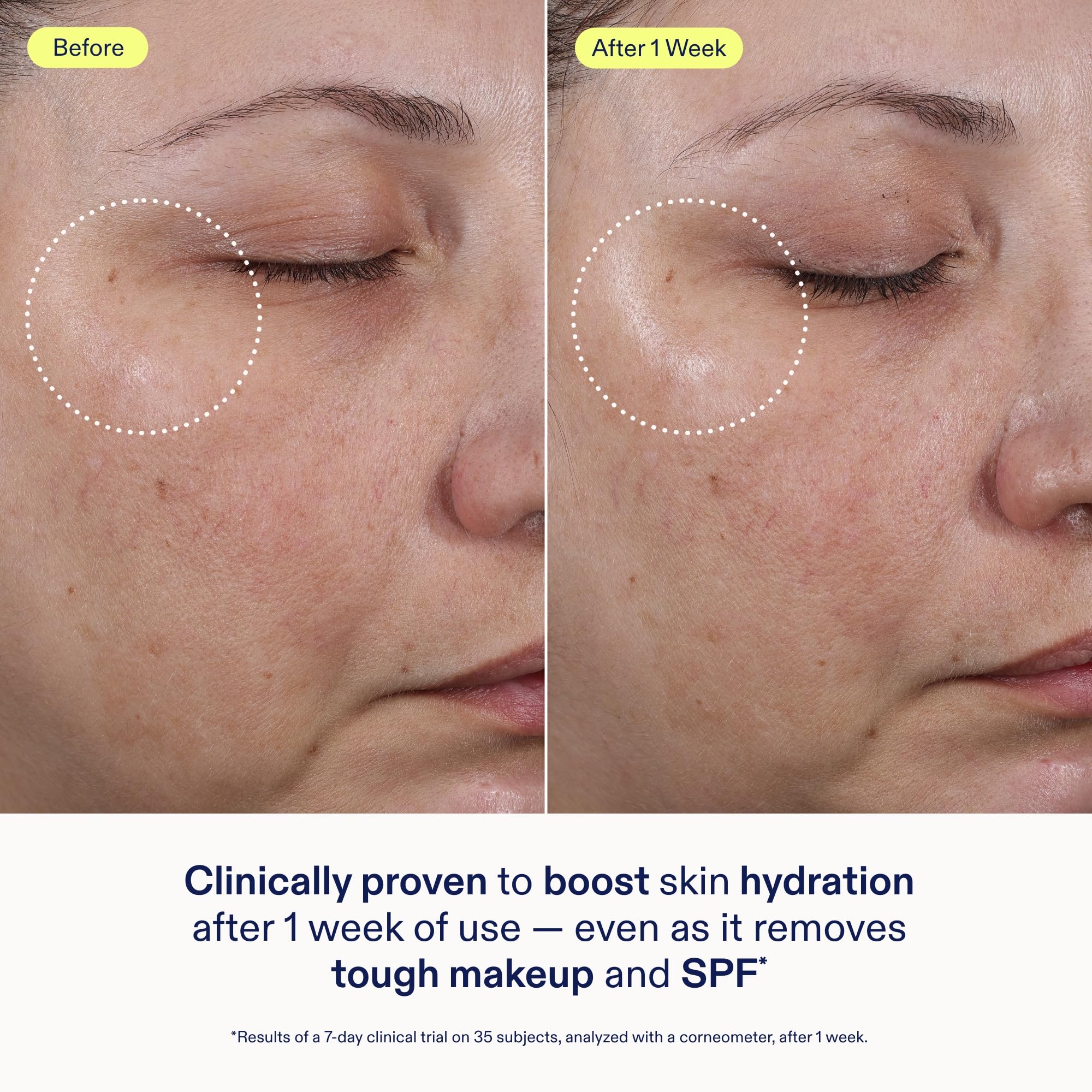 Manos aplicando el limpiador Skinfix para uso diario.