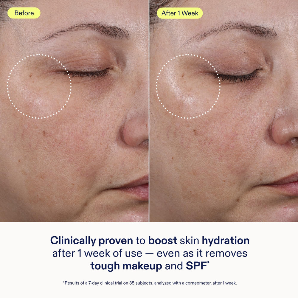 Manos aplicando el limpiador Skinfix para uso diario.