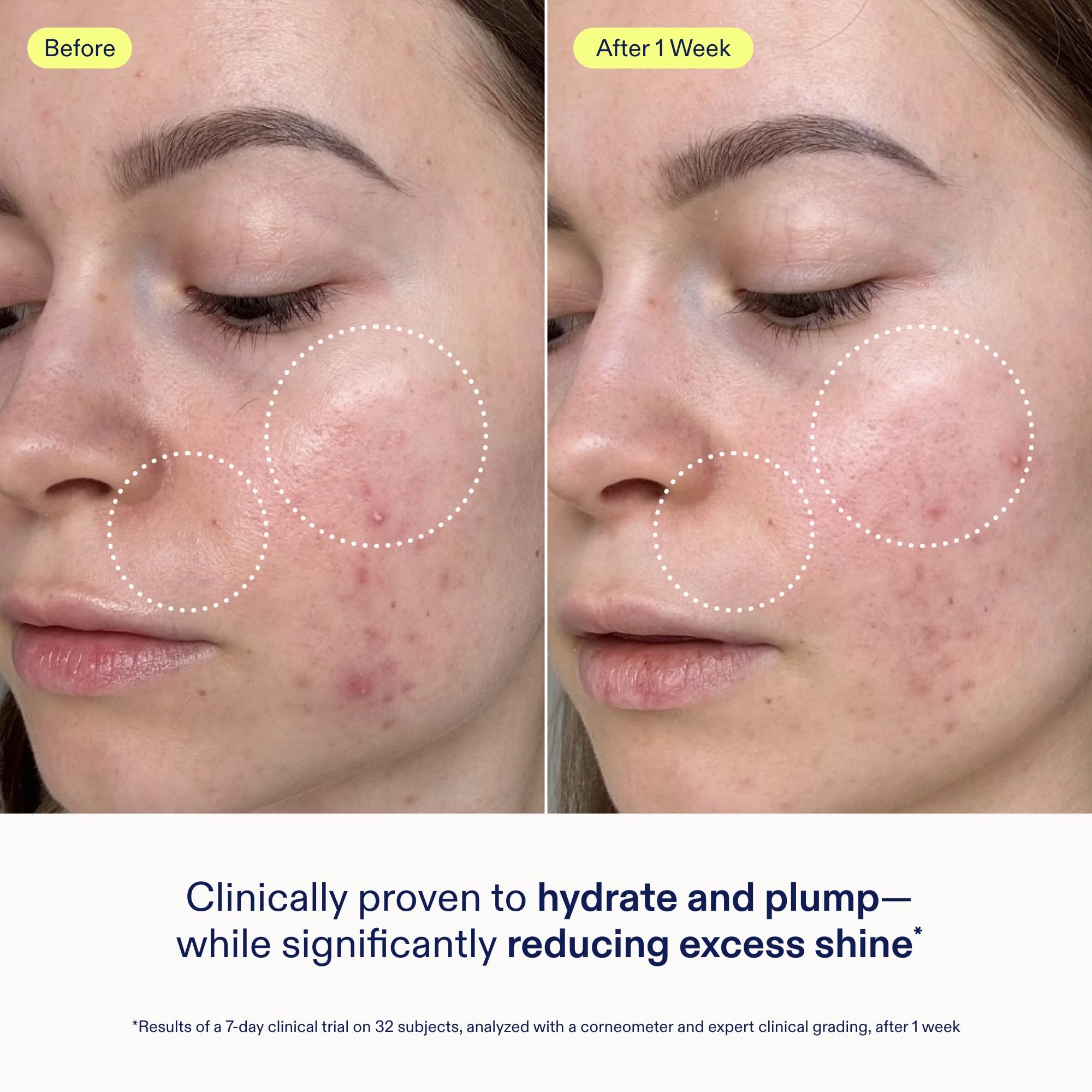 Hidratación continua de Skinfix, piel más suave y luminosa.