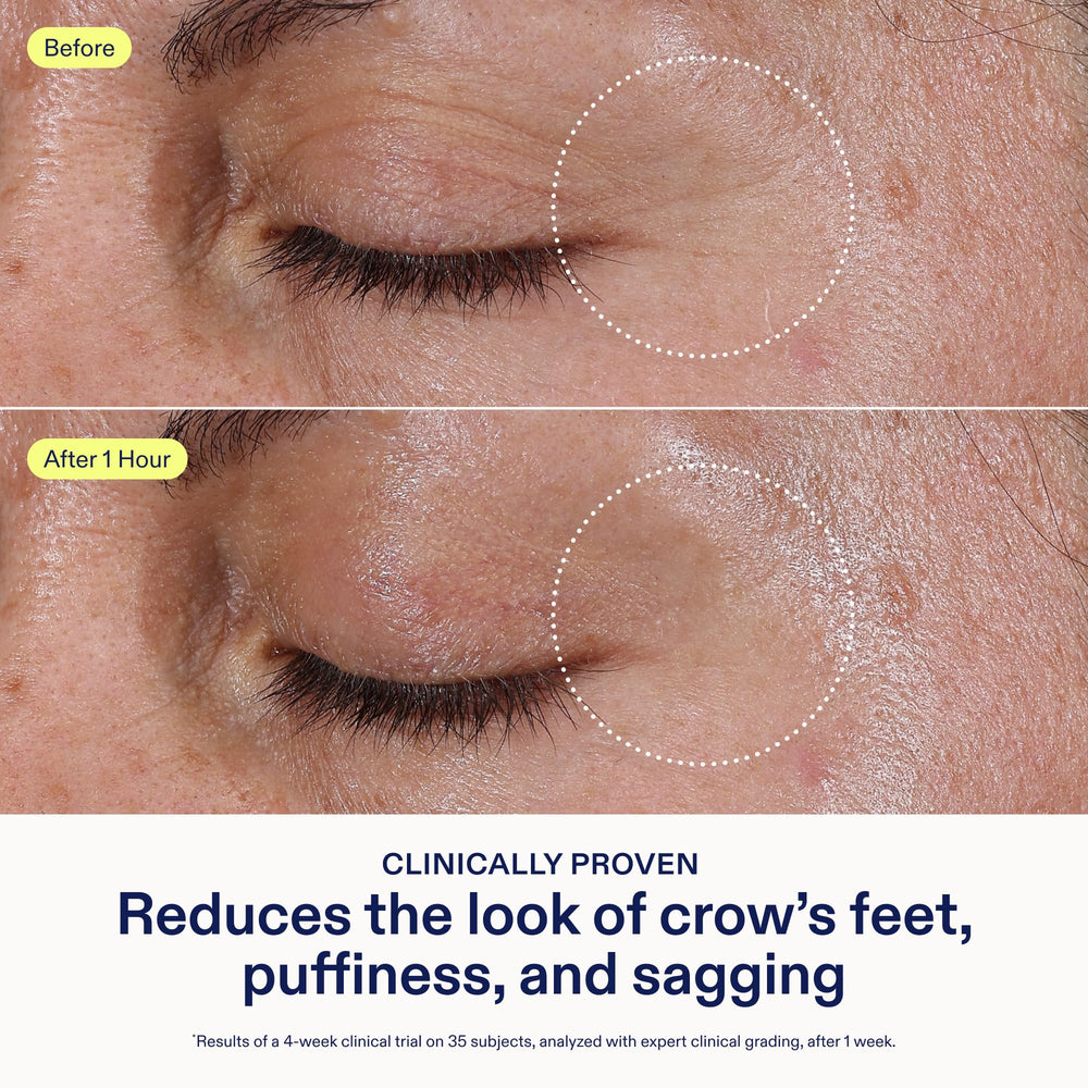 Skinfix con cafeina y niacinamida, ingrediente clave para el contorno de ojos.