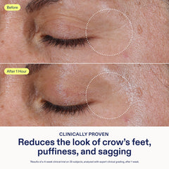 Skinfix con cafeina y niacinamida, ingrediente clave para el contorno de ojos.
