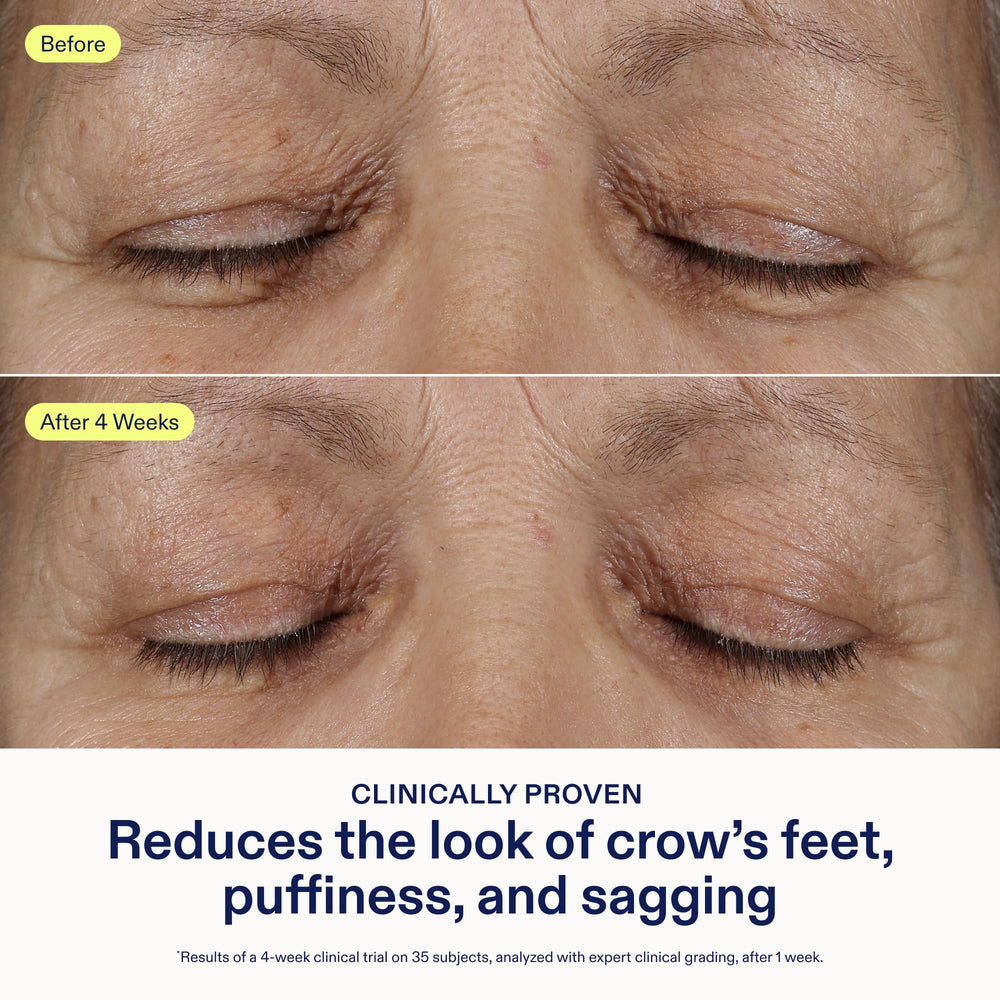 Skinfix con ceramidas 3 por ciento para retener humedad en la zona ocular.