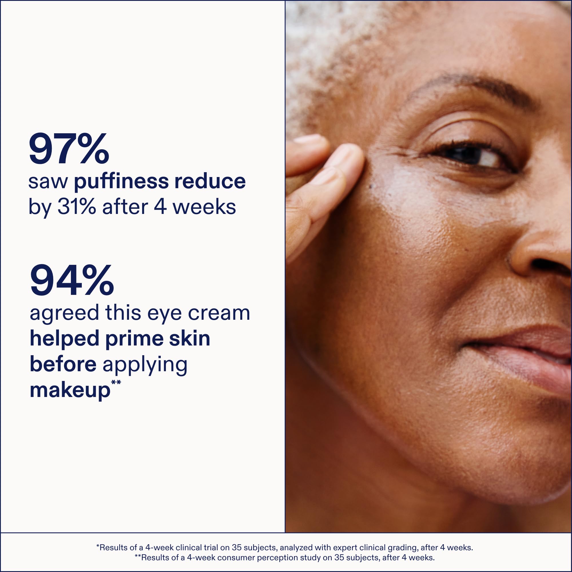 Skinfix factores de crecimiento, péptidos para mejora visible de la elasticidad ocular.
