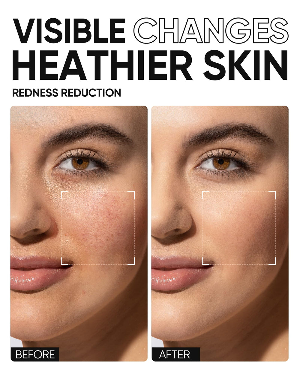 SKINTIFIC formula-sin-fragancias cuida piel sensible sin irritación