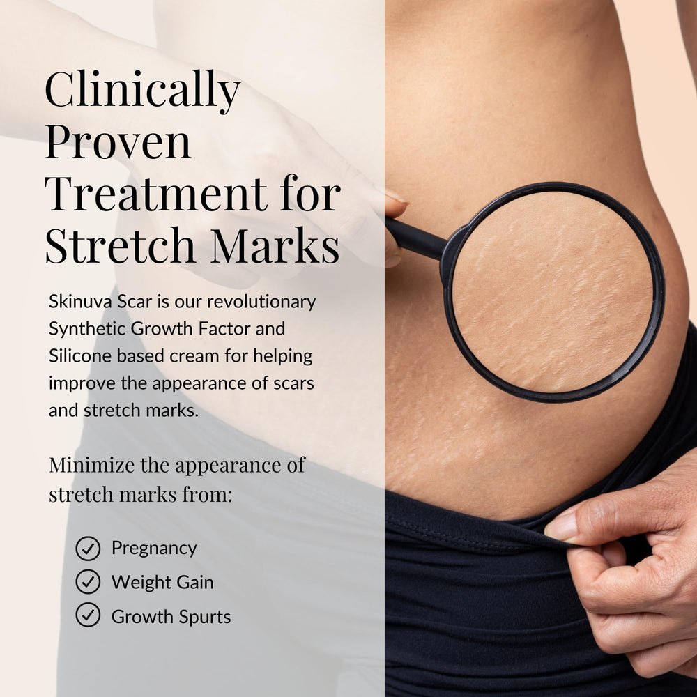 Skinuva ácido hialurónico, ayuda a suavizar irregularidades de la piel.