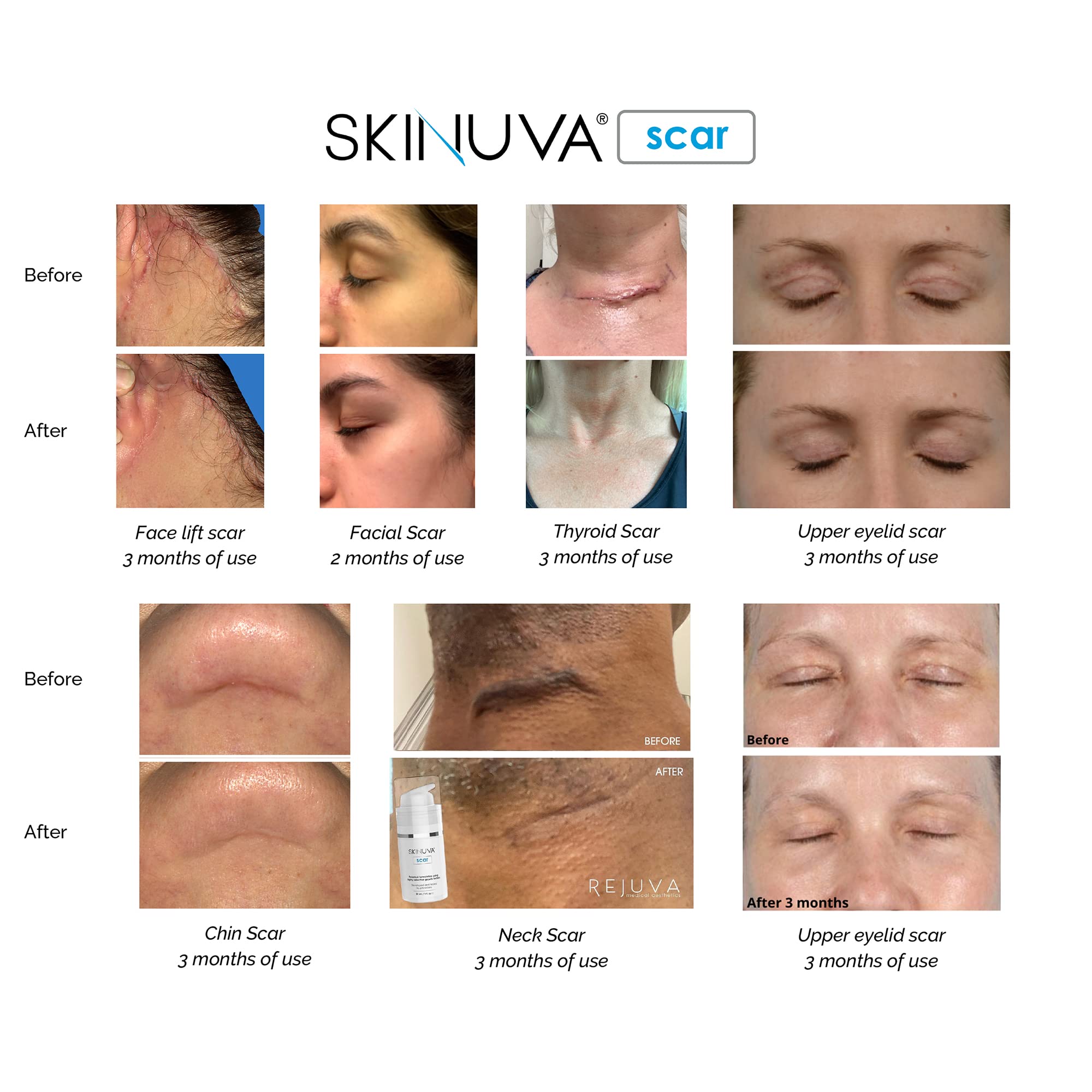 Skinuva aplicación dos veces al día, uso práctico para resultados sostenidos.