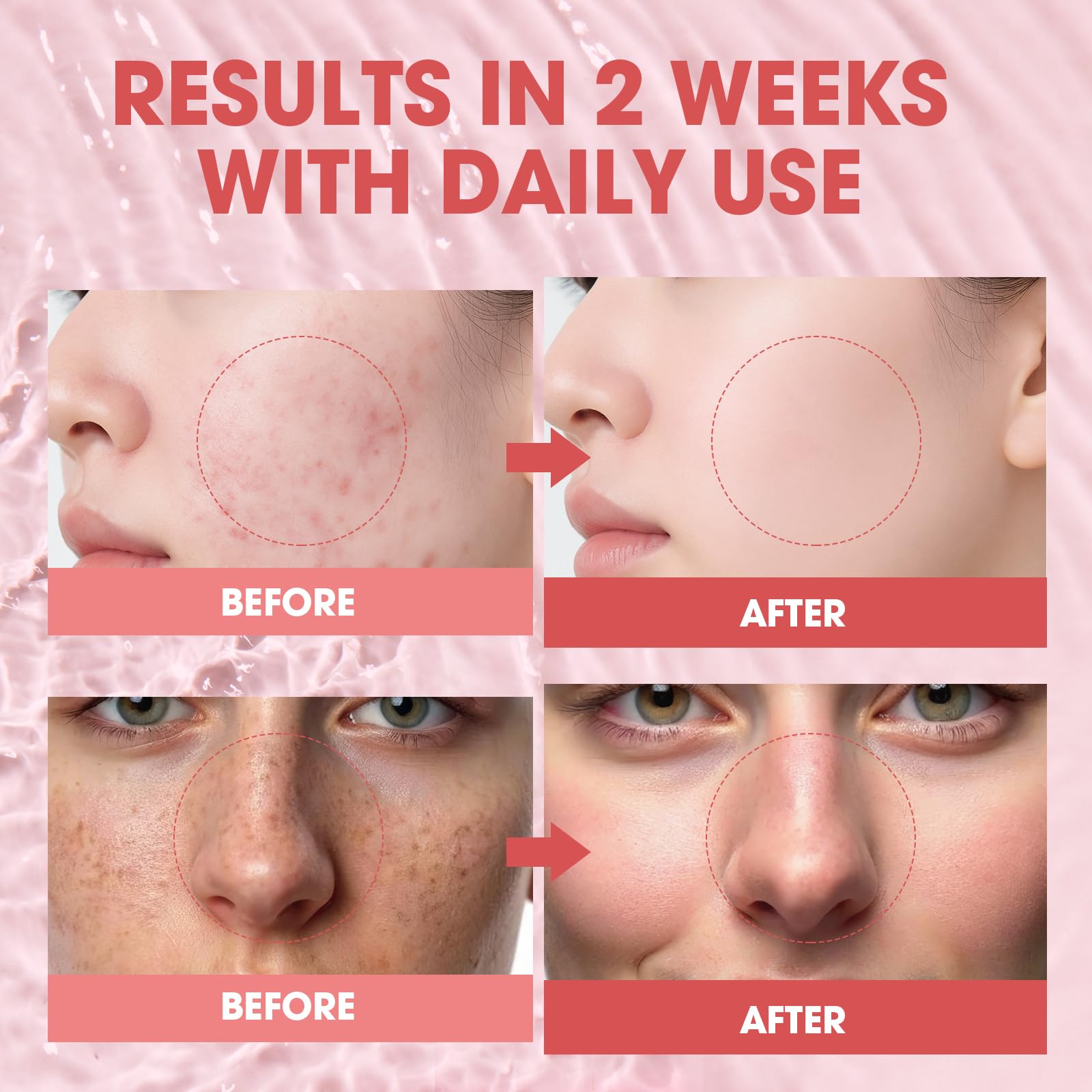 SKSOYT serum péptidos 12 con niacinamida, tono uniforme tras uso regular.