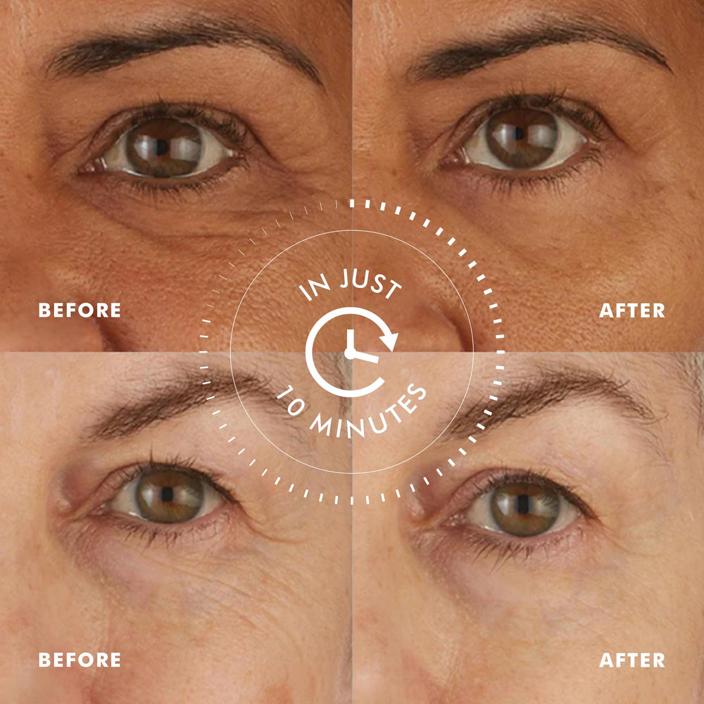 Parches con Ginkgo y antioxidantes para deshinchar e iluminar la mirada