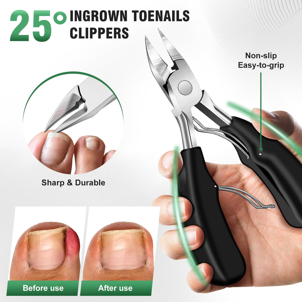 SMZHealing lima para uñas encarnadas para un acabado suave.