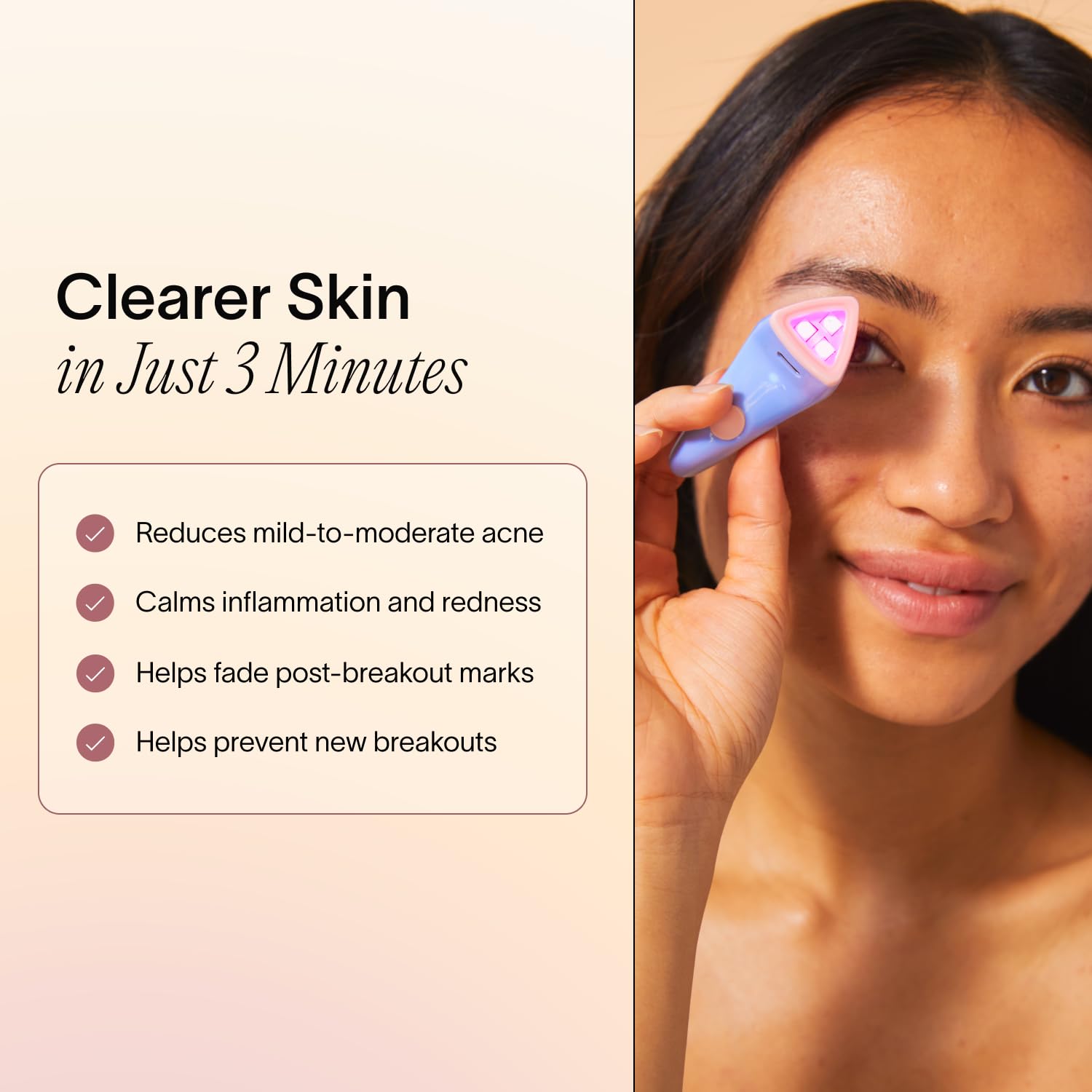 Solawave Bye Acne con luz roja para reducir enrojecimiento y apoyar la renovación de la piel.