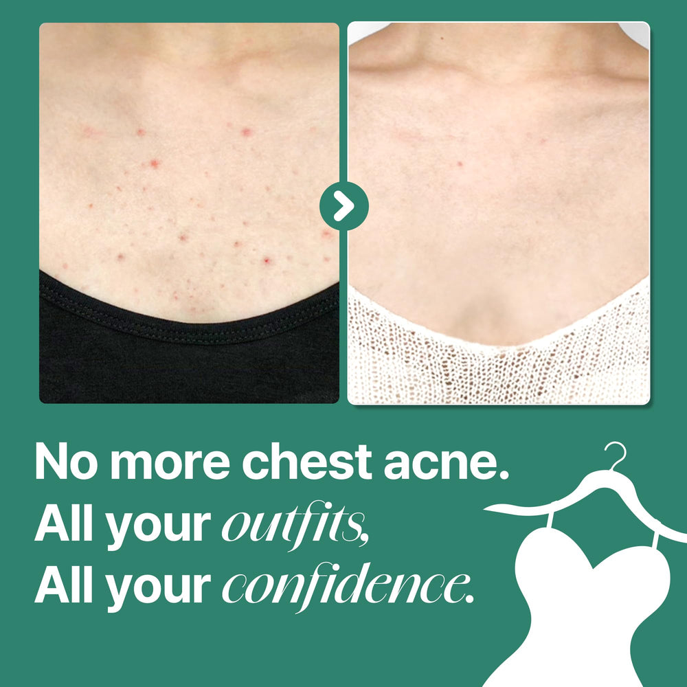 SOME BY MI Acide salicylique – nettoyant corps qui peut aider à clarifier la peau