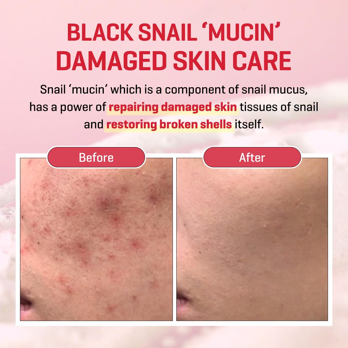 Aplicador suave facilita la rutina diaria de cuidado facial.