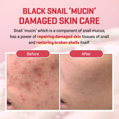 Aplicador suave facilita la rutina diaria de cuidado facial.