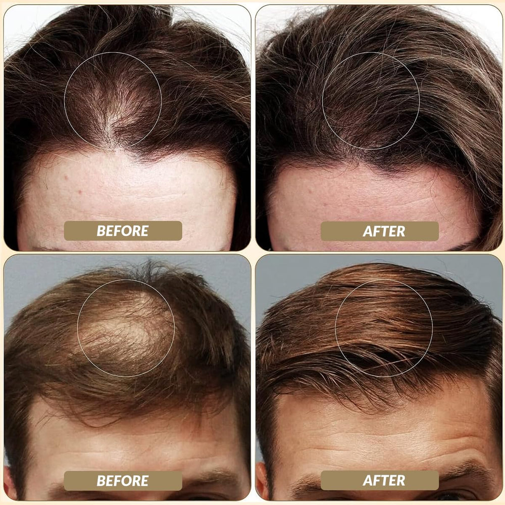 SOVONCARE Fibras capilares efecto llenado: camuflan imperfecciones para un look natural.