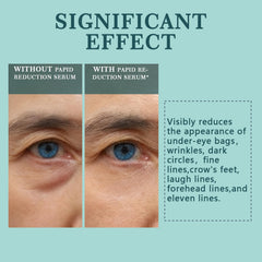 Spec Ask Serum se aplica alrededor de ojos para deshinchar al instante.
